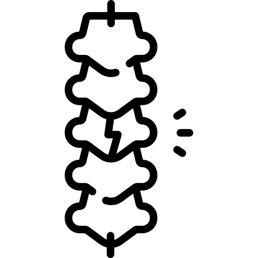 Accidente cerebrovascular